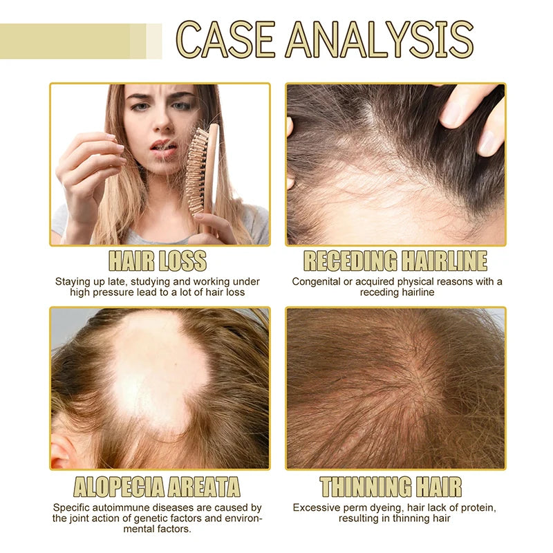 Natural Hair Growth Oil Efficient anti Hair Loss Nourishing Essential Oil for Dense Repair Damaged Hair Moisturizing Smooth Oil